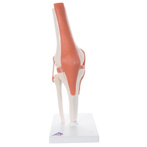 무릎관절 (A82)