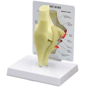 무릎관절 (G100)