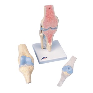 무릎관절 - 단면, 3분리 (A89)