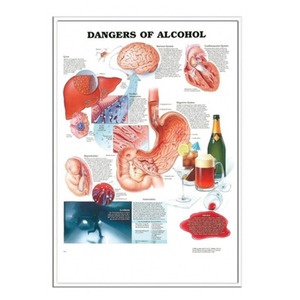 차트 - 입체, 알코올의 위험 (9696)