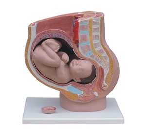 여성골반 - 단면, 태아, 4분리 (332B)