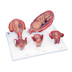 임신태아발달 - 5단계 (L11/9)